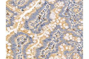 ABIN6263342 and ABIN6272964 at 1/100 staining Rat colon tissue by IHC-P. (MPV17 抗体  (Internal Region))