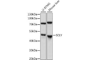 Western blot analysis of extracts of various cell lines, using SCLY antibody (ABIN7270191) at 1:1000 dilution. (SCLY 抗体  (AA 284-453))