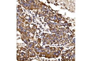 IHC analysis of MDH2 using anti-MDH2 antibody (ABIN7602618).