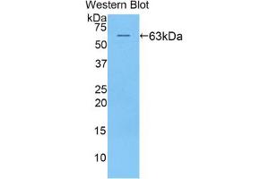 Western blot analysis of the recombinant protein. (KIR2DL2 抗体  (AA 22-348))