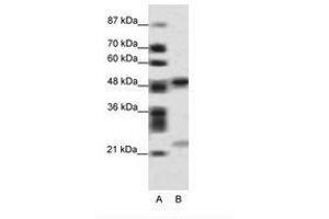 Image no. 1 for anti-PHD Finger Protein 11 (PHF11) (AA 171-220) antibody (ABIN6736092) (PHF11 抗体  (AA 171-220))