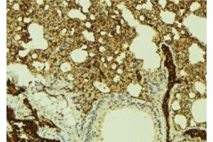 ABIN6269383 at 1/100 staining Mouse lung tissue by IHC-P. (ATRIP 抗体  (N-Term))