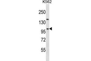 Western Blotting (WB) image for anti-Nucleolar Complex Associated 3 Homolog (NOC3L) antibody (ABIN2997653) (NOC3L 抗体)