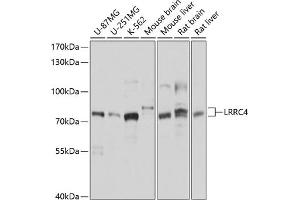 Western blot analysis of extracts of various cell lines, using LRRC4 antibody (ABIN6133394, ABIN6143343, ABIN6143344 and ABIN6214532) at 1:1000 dilution. (LRRC4 抗体  (AA 544-653))