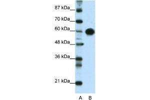 WB Suggested Anti-ZSCAN5 Antibody Titration:  0. (ZSCAN5A 抗体  (Middle Region))