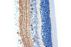 Immunohistochemistry of paraffin-embedded rat retina using CR Rabbit mAb (ABIN7266269) at dilution of 1:100 (40x lens). (CRABP1 抗体)