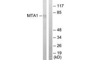 Western blot analysis of extracts from Jurkat cells, using MTA1 Antibody. (MTA1 抗体  (AA 171-220))