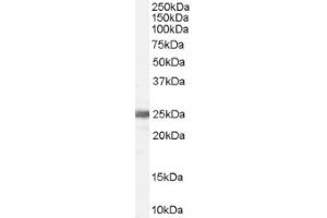 Image no. 1 for anti-Ribosomal Protein L19 (RPL19) (Internal Region) antibody (ABIN374694) (RPL19 抗体  (Internal Region))
