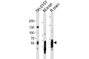 Western blot analysis of lysates from SH-SY5Y cell line, mouse brain, rat brain tissue lysate(from left to right), using PT Antibody (C-term) (ABIN6243259 and ABIN6577758). (MAPT 抗体  (C-Term))
