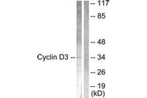 Western blot analysis of extracts from COS7 cells, treated with Forskolin 40nM 30', using Cyclin D3 (Ab-283) Antibody. (Cyclin D3 抗体  (AA 243-292))