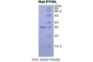 SDS-PAGE (SDS) image for phosphorylase, Glycogen, Liver (PYGL) (AA 73-267) protein (His tag) (ABIN1877626) (PYGL Protein (AA 73-267) (His tag))
