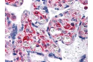 Immunohistochemical analysis of paraffin-embedded human Placenta tissues using VCAM1 mouse mAb (VCAM1 抗体)