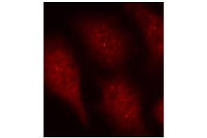 Immunofluorescence staining of methanol-fixed Hela cells using Phospho-CDK6-Y24 antibody. (CDK6 抗体  (pTyr24))