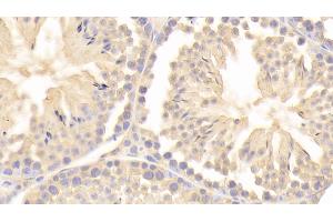 Immunohistochemistry (IHC) image for anti-Peptidylprolyl Isomerase A (Cyclophilin A) (PPIA) (AA 2-164) antibody (ABIN7432964)