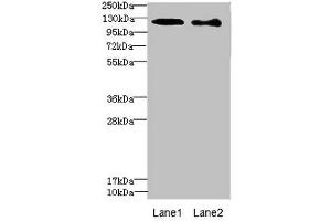 Western blot All lanes: DIAPH2 antibody at 4. (DIAPH2 抗体  (AA 1-120))