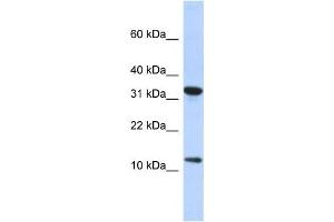 Western Blotting (WB) image for anti-Basic Transcription Factor 3 Pseudogene 11 (BTF3P11) antibody (ABIN2458156) (BTF3P11 抗体)