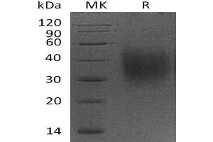 Western Blotting (WB) image for CD47 (CD47) (Active) protein (His tag) (ABIN7320544) (CD47 Protein (CD47) (His tag))