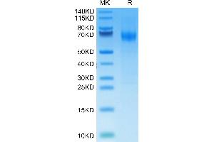 SDS-PAGE (SDS) image for Interferon alpha (IFNA) (AA 27-429) protein (His-Avi Tag) (ABIN7274853)