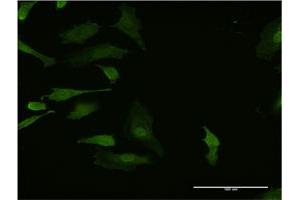Immunofluorescence of monoclonal antibody to HHEX on HeLa cell. (HHEX 抗体  (AA 133-237))