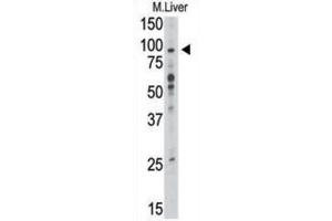 Western Blotting (WB) image for anti-Toll-Like Receptor 6 (TLR6) antibody (ABIN2998415)