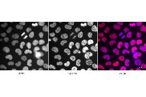Detection of H3panAc by immunofluorescence. (Histone 3 抗体  (acLys))