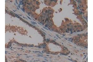 Immunohistochemistry (IHC) image for anti-Apoptosis-Associated tyrosine Kinase (AATK) (AA 1216-1374) antibody (ABIN7442786)