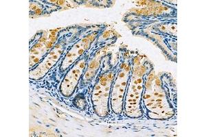 Immunohistochemistry (Paraffin-embedded Sections) (IHC (p)) image for anti-Solute Carrier Family 30 (Zinc Transporter), Member 1 (SLC30A1) antibody (ABIN7075672)
