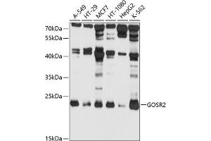 Western blot analysis of extracts of various cell lines, using GOSR2 antibody (ABIN1680068, ABIN3018813, ABIN3018814 and ABIN6220587) at 1:1000 dilution. (GOSR2 抗体  (AA 1-190))
