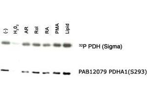 Western blot analysis of PDHA1 in an in vitro autophosphorylation of PDH complex in response to different stimulants with PDHA1 (phospho S293) polyclonal antibody . (PDHA1 抗体  (pSer293))