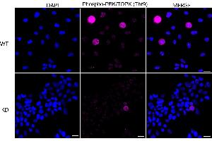 Immunocytochemical staining of HeLa cells using Phospho-PBK/TOPK (Thr9) antibody (ABIN7799752), 1:1,000), Top panel: wild-type (WT), Bottom panal: Phospho-PBK/TOPK (Thr9) shRNA knockdown (KD). (Recombinant PBK 抗体  (pThr9))