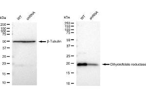 Western blotting analysis using Dihydrofolate reductase antibody (ABIN7798334). (Recombinant Dihydrofolate Reductase 抗体)