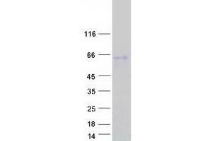 Western Blotting (WB) image for Sp5 Transcription Factor (SP5) protein (Myc-DYKDDDDK Tag) (ABIN2732481)