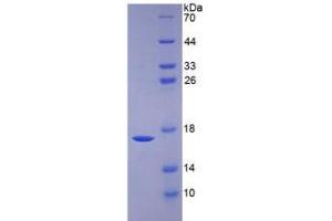 SDS-PAGE analysis of Human BMP6 Protein. (BMP6 蛋白)