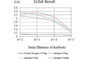 Black line: Control Antigen (100 ng),Purple line: Antigen (10 ng), Blue line: Antigen (50 ng), Red line:Antigen (100 ng) (CKM 抗体  (AA 1-381))