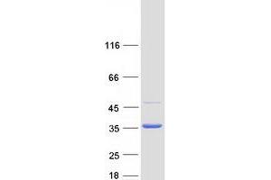 Eukaryotic Translation Elongation Factor 1 beta 2 (EEF1B2) (Transcript Variant 2) protein (Myc-DYKDDDDK Tag)