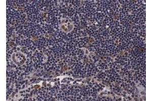 ABIN6266697 at 1/100 staining human lymph node tissue sections by IHC-P. (PDZD2 抗体  (N-Term))