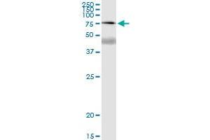 Immunoprecipitation of SSX2IP transfected lysate using anti-SSX2IP MaxPab rabbit polyclonal antibody and Protein A Magnetic Bead , and immunoblotted with SSX2IP purified MaxPab mouse polyclonal antibody (B01P) . (SSX2IP 抗体  (AA 1-614))