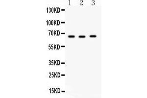 Western Blotting (WB) image for anti-Solute Carrier Family 19 (Folate Transporter), Member 1 (SLC19A1) (AA 202-231), (Middle Region) antibody (ABIN3043543)