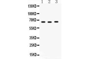 Anti-SLC19A1 Picoband antibody, Western blottingAll lanes: Anti SLC19A1  at 0. (SLC19A1 抗体  (Middle Region))