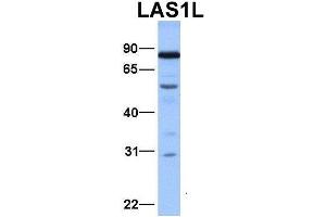 Host:  Rabbit  Target Name:  LAS1L  Sample Type:  Hela  Antibody Dilution:  1.