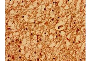 Immunohistochemistry (IHC) image for anti-Glutamate Receptor, Ionotropic, N-Methyl D-Aspartate 2a (GRIN2A) (AA 501-750) antibody (ABIN7153987)