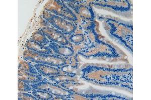 Used in DAB staining on fromalin fixed paraffin- embedded intestine tissue (PLAT 抗体  (AA 311-487))