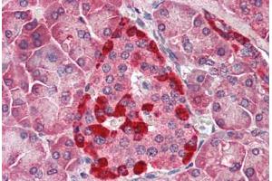 Human Pancreas (formalin-fixed, paraffin-embedded) stained with CASP1 antibody ABIN461892 at 5 ug/ml followed by biotinylated goat anti-rabbit IgG secondary antibody ABIN481713, alkaline phosphatase-streptavidin and chromogen. (Caspase 1 抗体)
