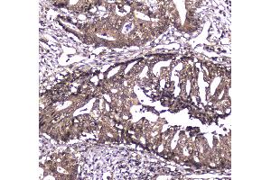 IHC analysis of Caspase 4 using anti-Caspase 4 antibody . (Caspase 4 抗体  (AA 111-194))