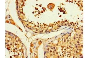 Immunohistochemistry of paraffin-embedded human testis tissue using ABIN7144946 at dilution of 1:100 (ACLY 抗体  (AA 4-265))