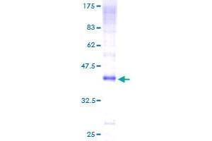 CLEC7A Protein (AA 1-77) (GST tag)