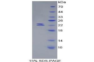 SDS-PAGE analysis of Mouse BMP1 Protein. (BMP1 蛋白)