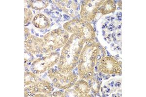 Immunohistochemistry of paraffin-embedded rat liver using HADH antibody (ABIN5970434) at dilution of 1/100 (40x lens). (HADH 抗体)