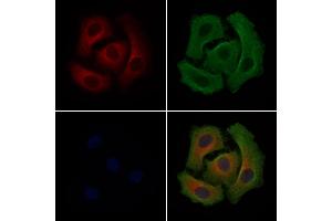 ABIN6265118 and ABIN6279217 staining Hela cells by IF/ICC. (slc25a13 抗体  (C-Term))