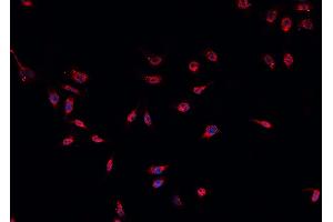 ABIN6266588 staining U-2 OS cells by IF/ICC. (MDM2 抗体)